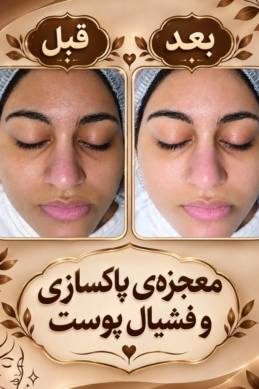 فشیال وپاکسازی تخصصی پوست (سالن زیبایی در یزد) — عکس ۴