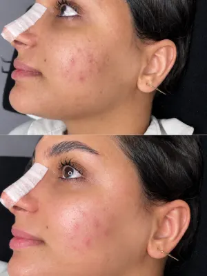 فشیال وپاکسازی تخصصی پوست (سالن زیبایی در یزد)