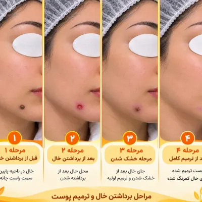 فشیال وپاکسازی تخصصی پوست (سالن زیبایی در یزد)